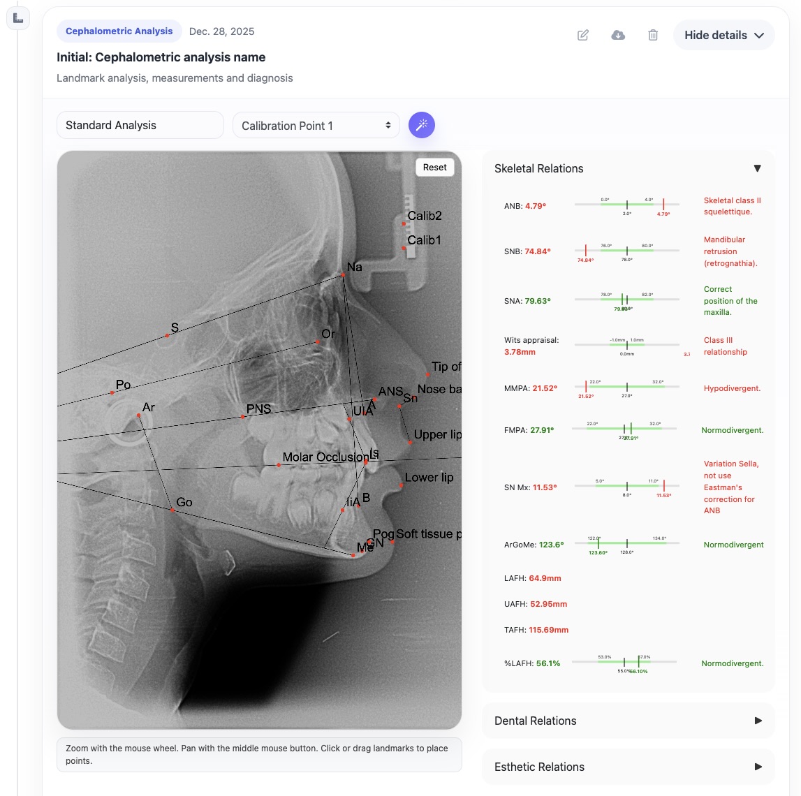 Cephalometric analysis report preview