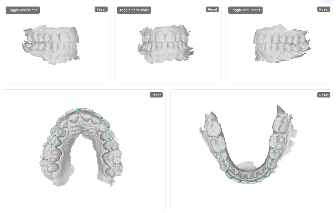 Bolton and orthodontic analysis preview